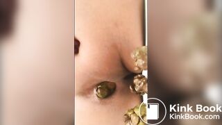 redbone dookie nuggets