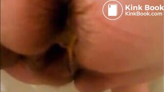 Mature woman shitting diarrhea closeup