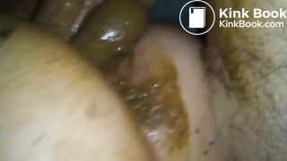 Scatfuck with shit filled condom