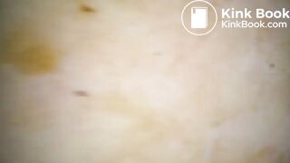 Scatfuck with shit filled condom