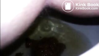 Girl shitting diarrhea in the toilet closeup