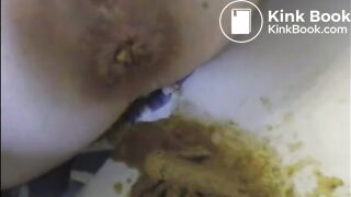 Woman shitting a very liquid diarrhea