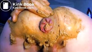 Girl shitting diarrhea and fisting asshole