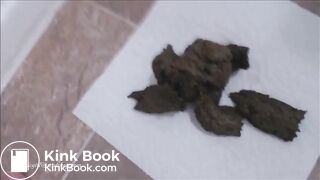 trou du cul malformé