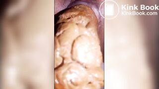 Lot of shit from her ass in close-up