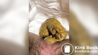 Hairy girl poops on the diaper