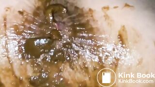 Sexy Girl gets a Piss-Enema and shits on herself