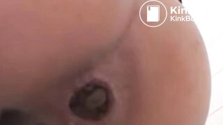 Närbild Anus