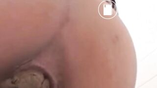 Närbild Anus