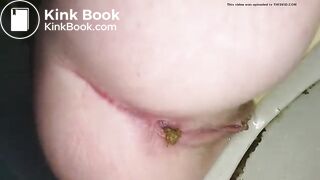 dookie hurts 1