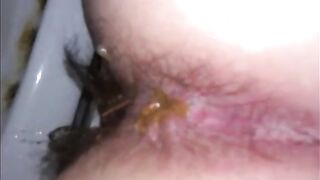 Hairy woman shitting closeup on a dirty toilet