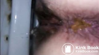 Hairy woman shitting closeup on a dirty toilet