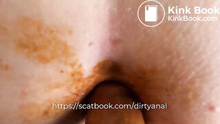 Dirty anal scat