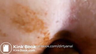 Dirty anal scat