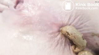 au bord de l'anus