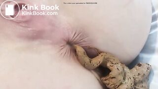 au bord de l'anus