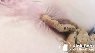au bord de l'anus