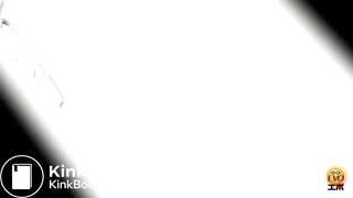 Massive constipation hard poop closeup