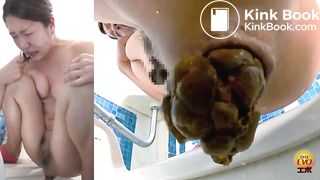 Massive constipation hard poop closeup