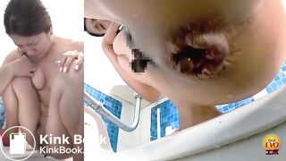 Massive constipation hard poop closeup