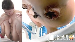 Massive constipation hard poop closeup