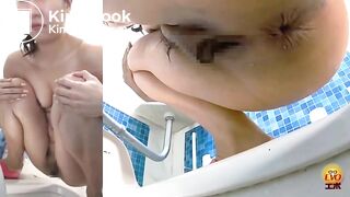 Massive constipation hard poop closeup