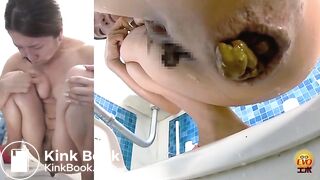 Massive constipation hard poop closeup