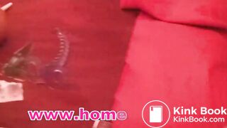 Cutouts Treatment with laxative suppositories and enemas