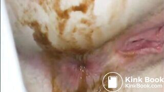 Runny Shit, Piss and Farts