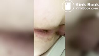 me Having a Shit