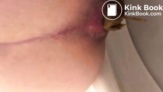 My huge poop