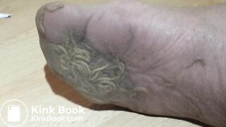 Wife Feet Tickling By Maggots All Night