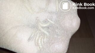 Look the Maggots eating my Toes