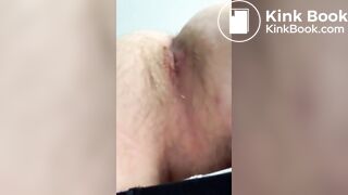 Randompoofs Farting