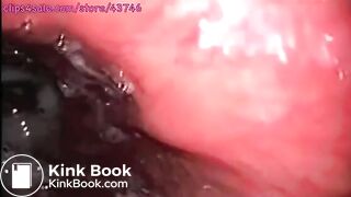 anal shit