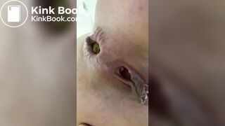 Pretty butthole shitting