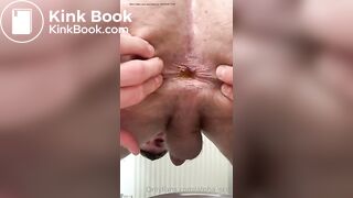 Scottish Alpha Shitting