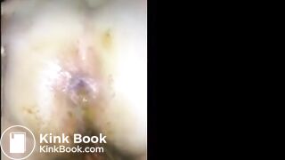 BBC Pounds Slag's Shitty Ass--Scat in Cunt