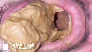 Shit Beast Eats My Full Dump