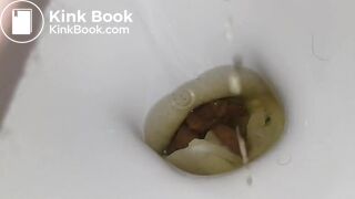 ALMOST POO AND WEE MYSELF but made it to toilet!