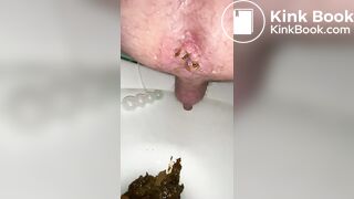 i shit