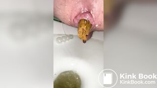 i shit