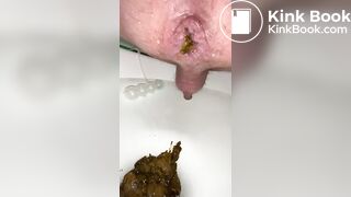 i shit