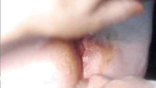 Chub Bear Daddy Diarrhea Feeding