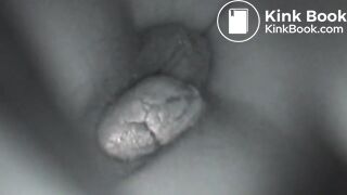 Scat Voyeur
