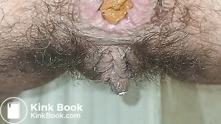 Hairy Dirty Girl Shitting On Your Face P2
