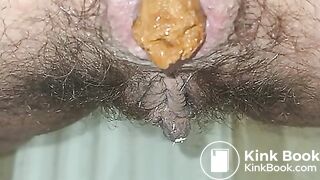 Hairy Dirty Girl Shitting On Your Face P2