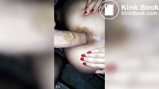 Very dirty anal fuck and gape