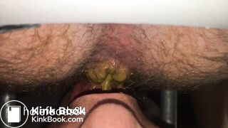 Explosive Diarrhea Feeding