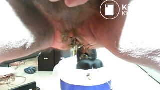 Enlarge my Asshole